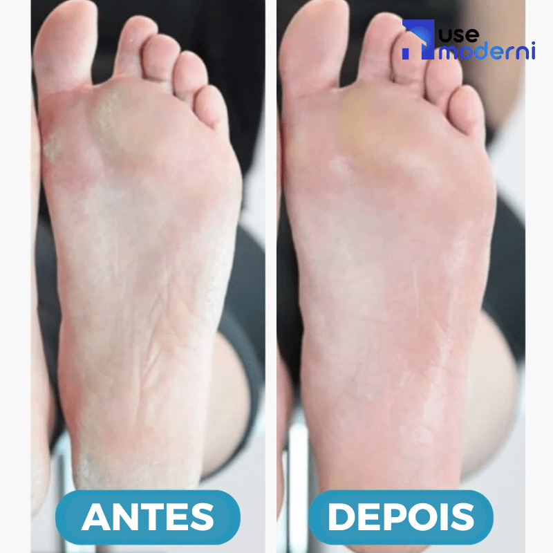 sapatlha ortopedica, sapatilha feminina, sapatilha moleca, sapatilha comprar, sapatilha confort