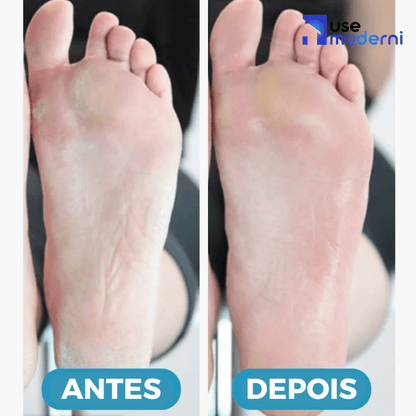 sapatlha ortopedica, sapatilha feminina, sapatilha moleca, sapatilha comprar, sapatilha confort