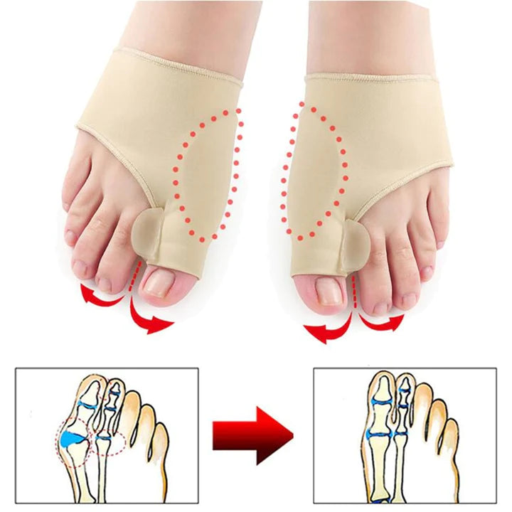 sapatlha ortopedica, sapatilha feminina, sapatilha moleca, sapatilha comprar, sapatilha confort